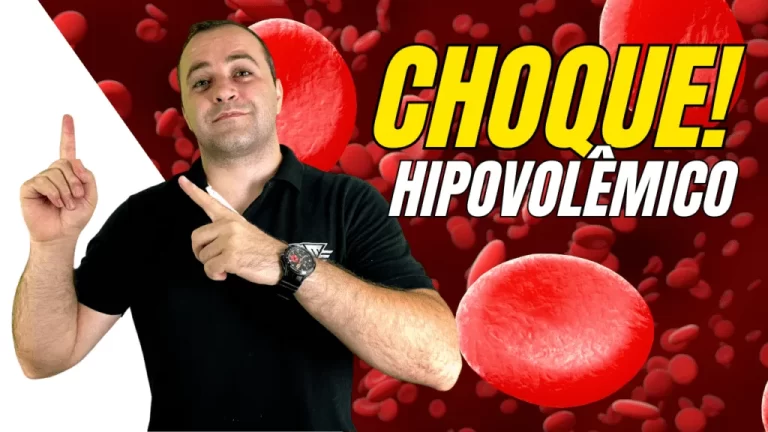 choque-hipovolêmico-fórmula-enfermagem;enfermagem-para-concursos